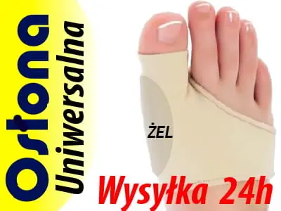 opaska_z_zelem_haluksy_oslona.jpg