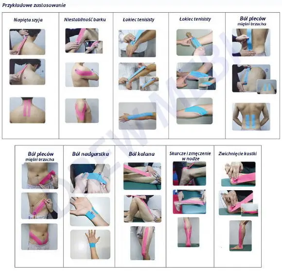 3ns_tex_kinesiotaping.jpg